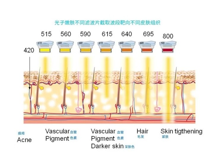 五大光子嫩膚技術(shù)（IPL、DPL、OPT、APT、BBL）及濾光片區(qū)別